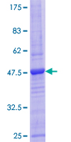 12.5% SDS-PAGE Stained with Coomassie Blue.